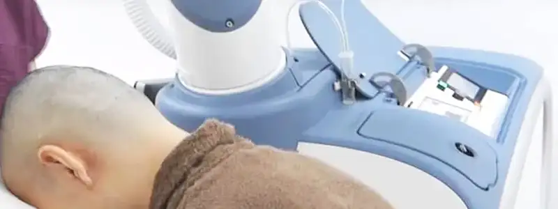 زراعة الشعر بتقنية الاقتطاف بالخلايا الجذعية في دبي